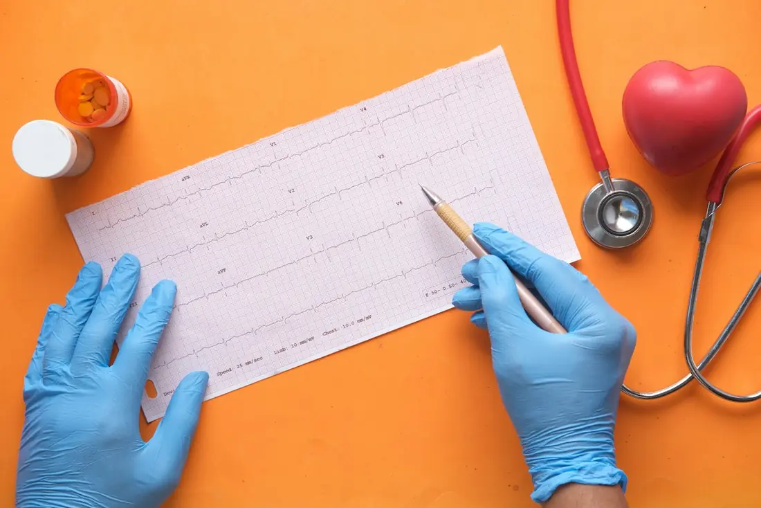 Gloved hands marking an ECG printout beside a stethoscope