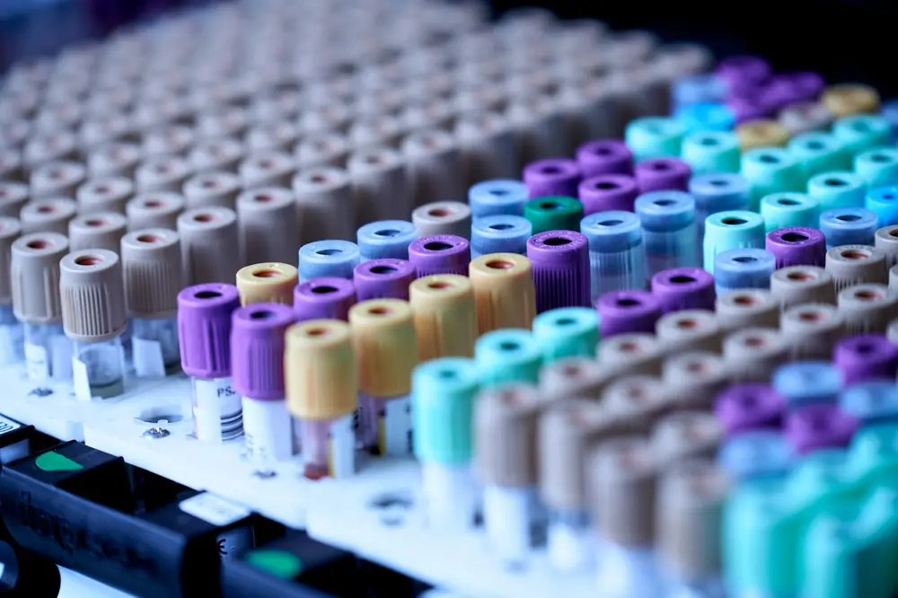 Rows of blood collection tubes with coloured caps